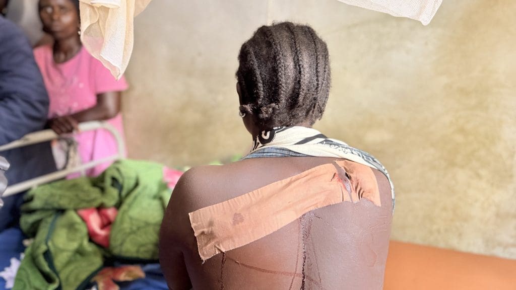 Civilian guard leader Shadrach Ishaku and Kyerna Ayuba are receiving treatment for bullet injuries in a hospital. Photo by Masara Kim/TruthNigeria.