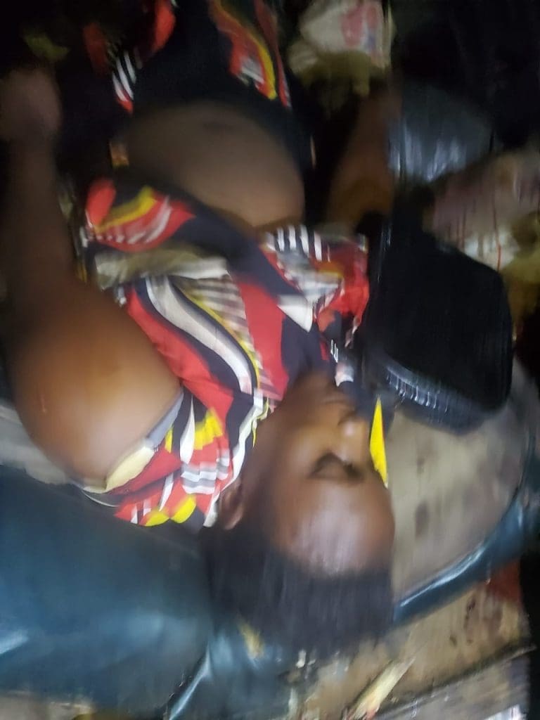 Survivors of Friday evening’s market shootings in Mangu, Plateau State undergoing treatment at a local hospital. Photos courtesy Jerry Datim