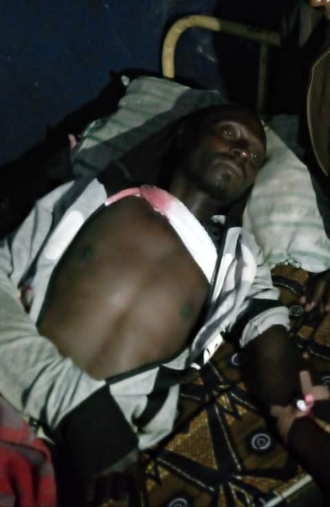 Zakarias Mani recovering from a machete attack by Fulani Ethnic Milita.  Photo by Mike Odeh James.